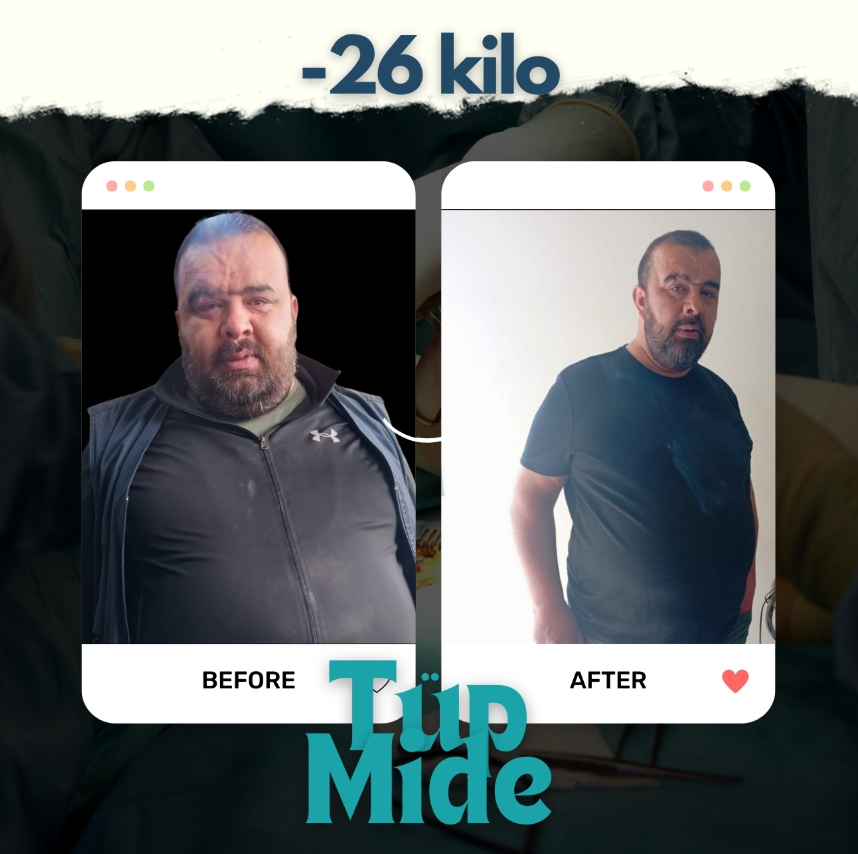 beforeafter1