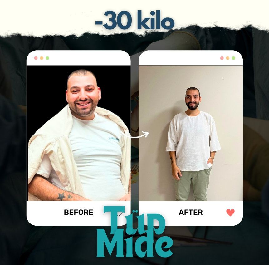 beforeafter2