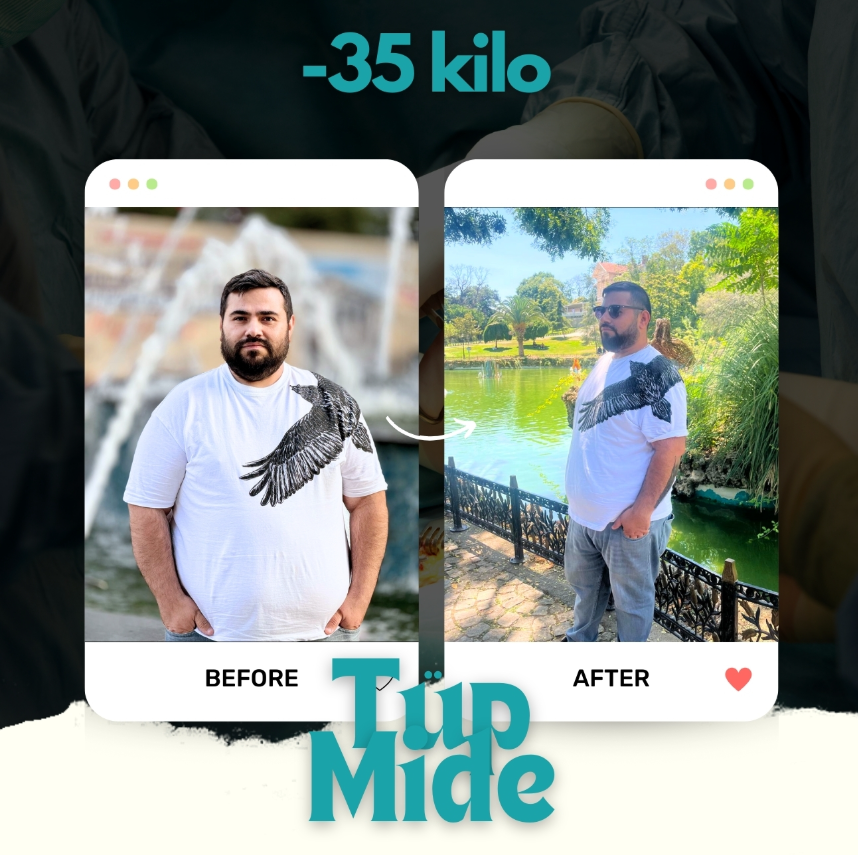 beforeafter3