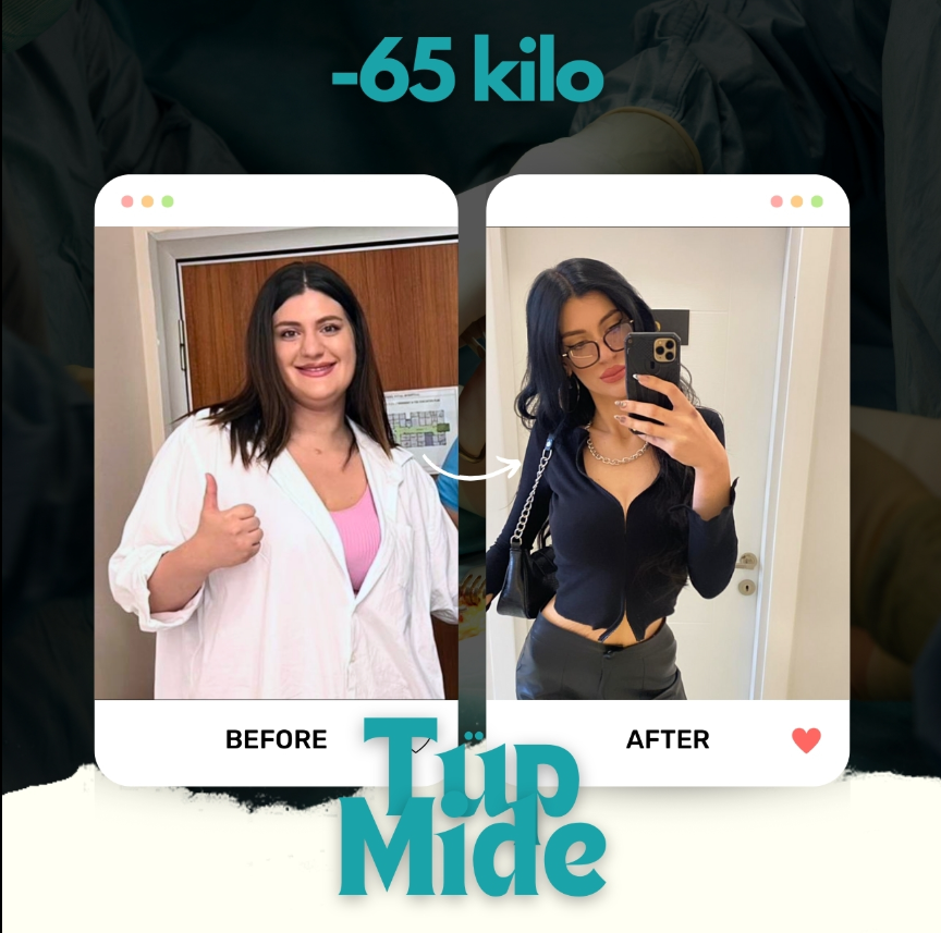beforeafter4